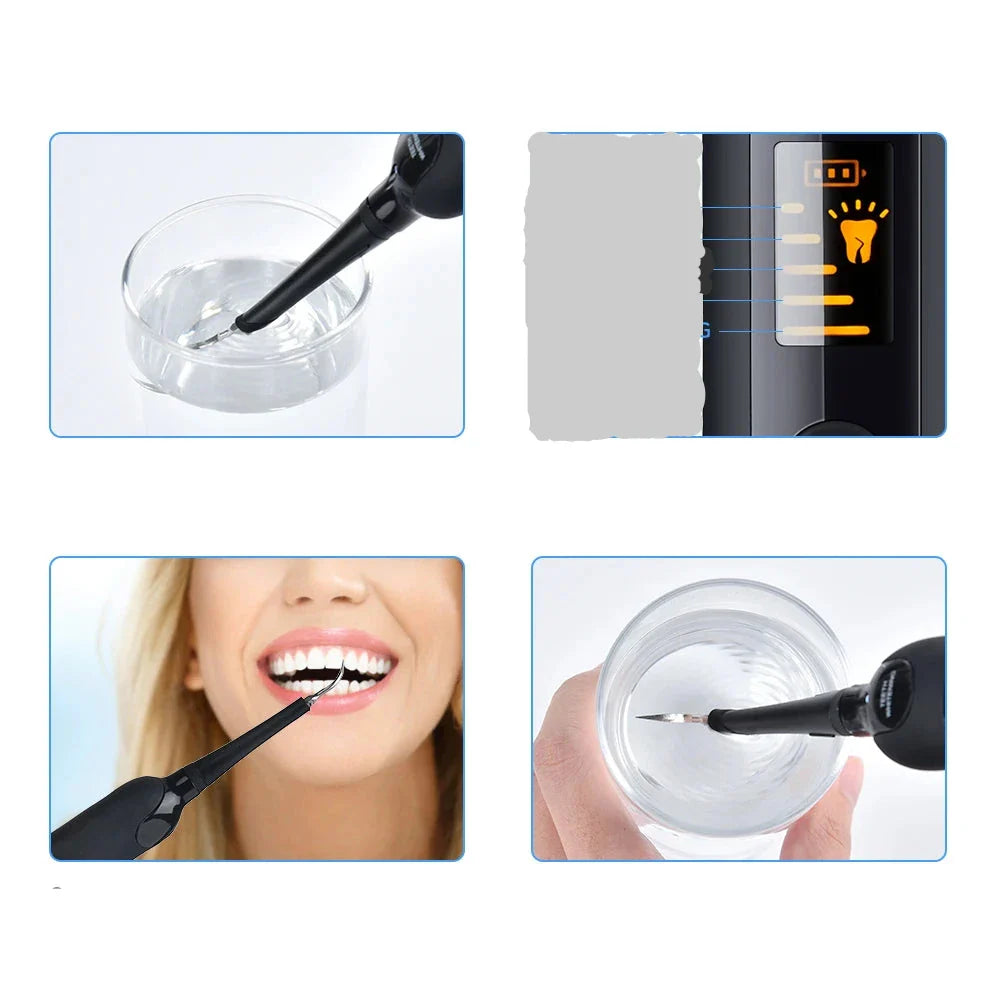 WhiteSpark™ Elektrischer 6-Stufen Zahnreiniger & Teeth Whitening – Wasserdicht, USB-C, Plaque & Zahnstein Entferner