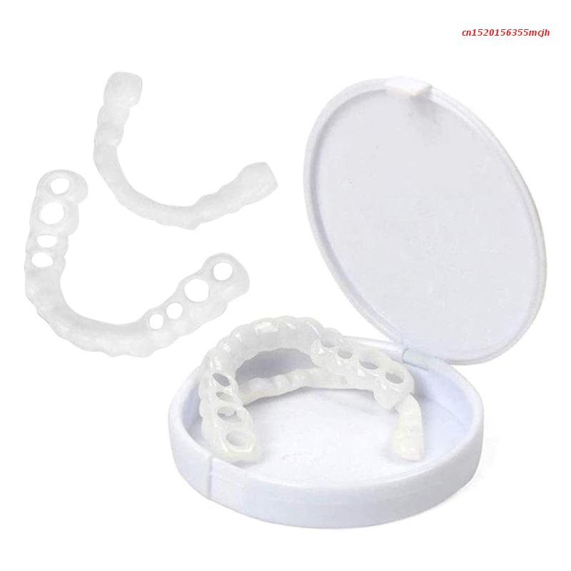 SmileSnap™ Perfect Veneer – Snap-On Veneers für ein sofortiges, strahlendes Lächeln