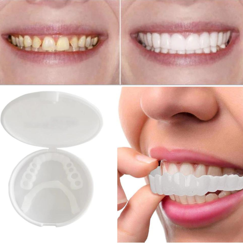 BrightBite™ – EasyClick Zahnprothese für ein Sofort-Lächeln ohne Zahnarzt