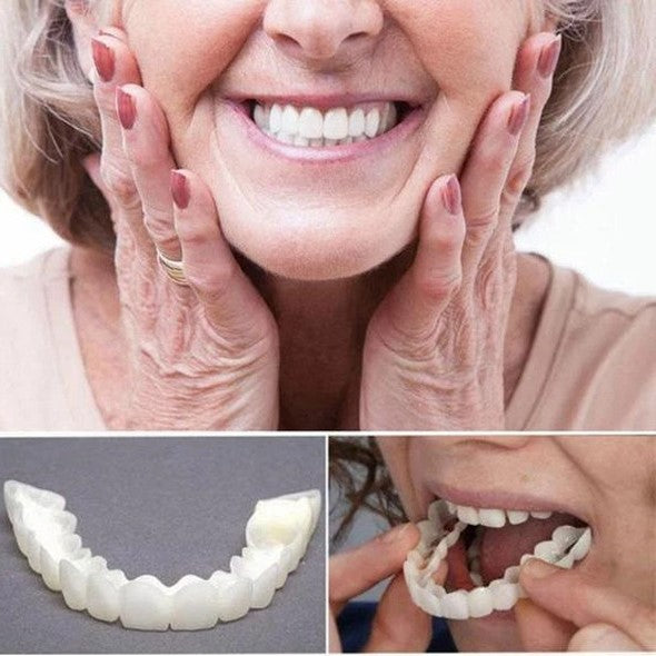 SmileGuard™ Veneers – Professionelle Snap-On Zahnverblendung für ein perfektes Lächeln