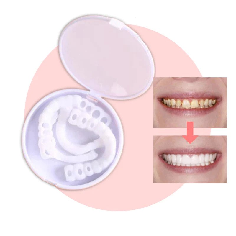 SmileSnap™ Perfect Veneer – Snap-On Veneers für ein sofortiges, strahlendes Lächeln
