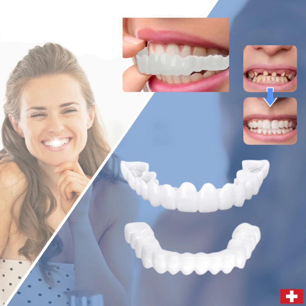 SmileSnap™ Perfect Veneer – Snap-On Veneers für ein sofortiges, strahlendes Lächeln